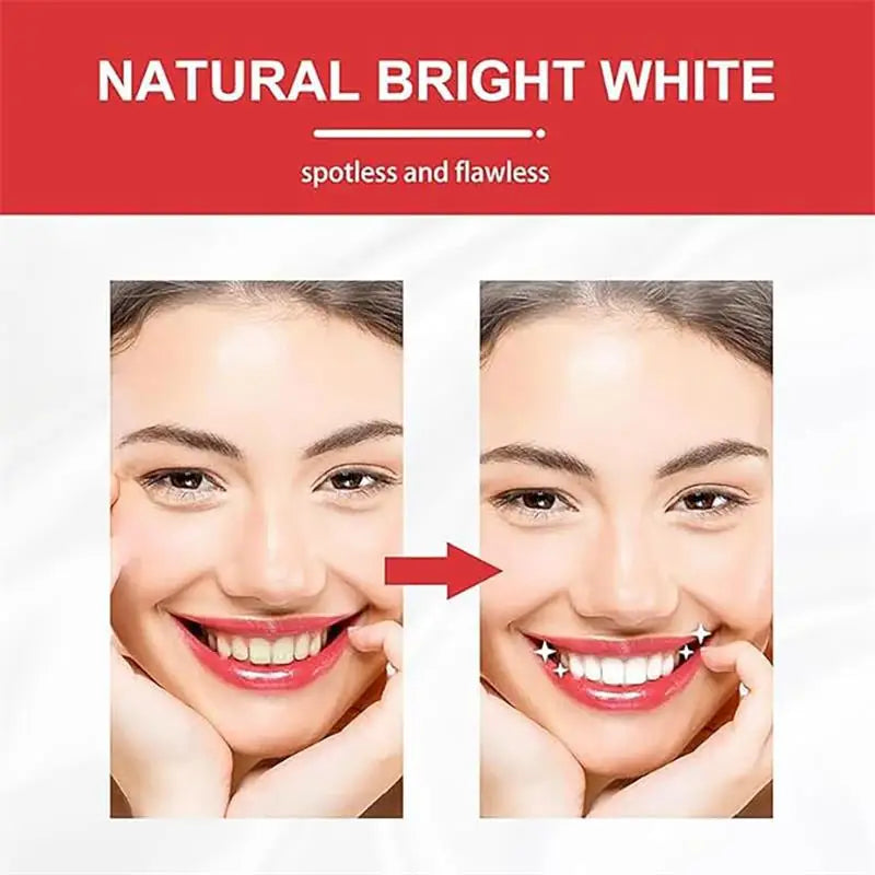 SP-10 Probiotic Toothpaste Whitens Teeth & Freshens Breath