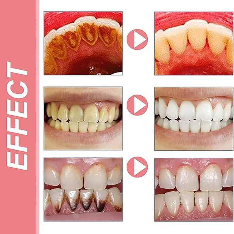 SP-10 Probiotic Toothpaste Whitens Teeth & Freshens Breath
