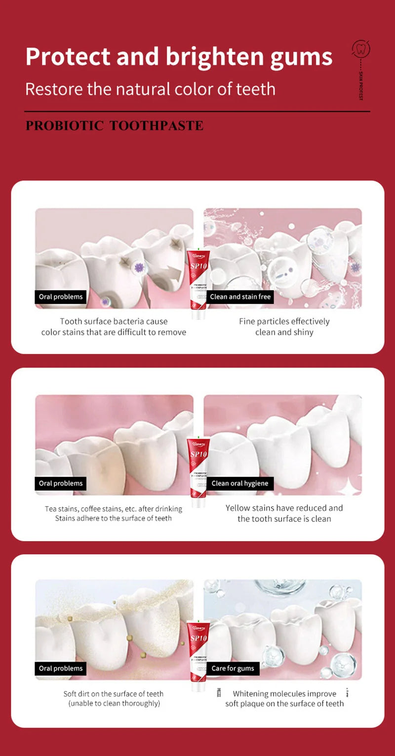 SP-10 Probiotic Toothpaste Whitens Teeth & Freshens Breath