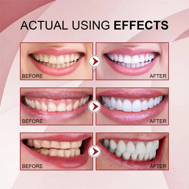 SP-10 Probiotic Toothpaste Whitens Teeth & Freshens Breath