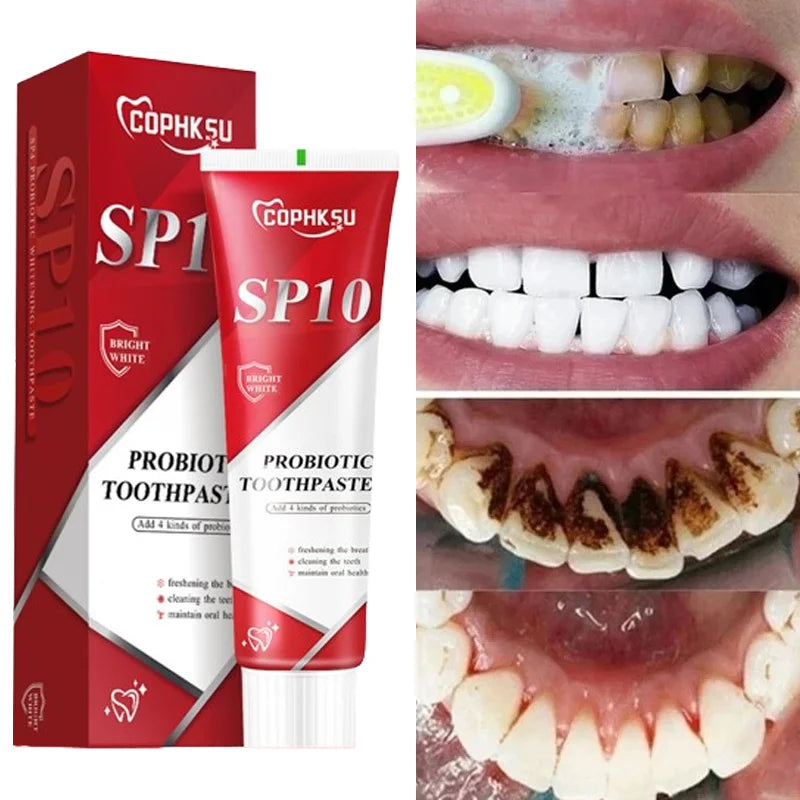 SP-10 Probiotic Toothpaste Whitens Teeth & Freshens Breath