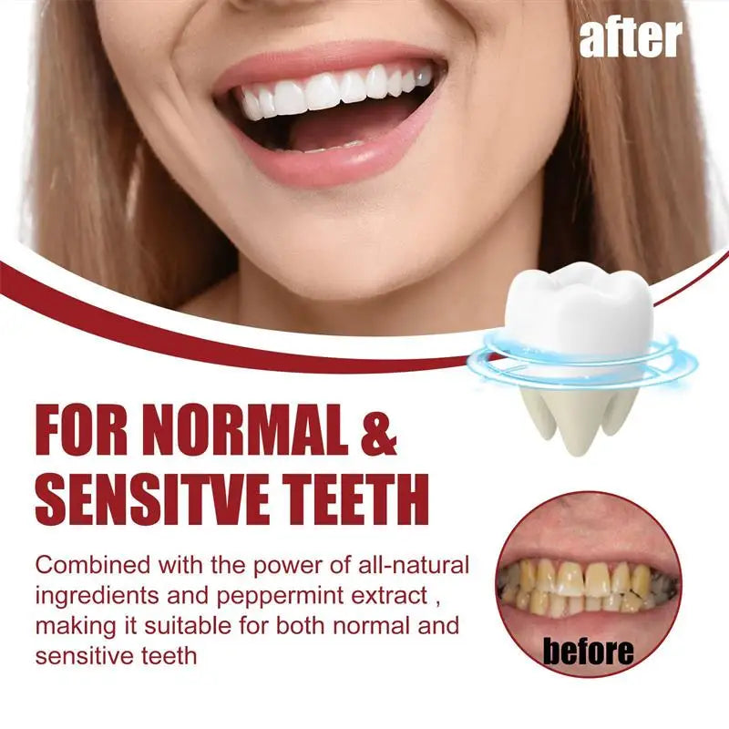 SP-10 Probiotic Toothpaste Whitens Teeth & Freshens Breath
